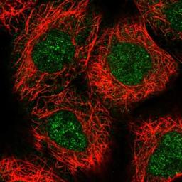 Immunocytochemistry/Immunofluorescence: Archaemetzincin 2 Antibody [NBP1-85996] - Immunofluorescent staining of human cell line A-431 shows positivity in nucleus but not nucleoli.