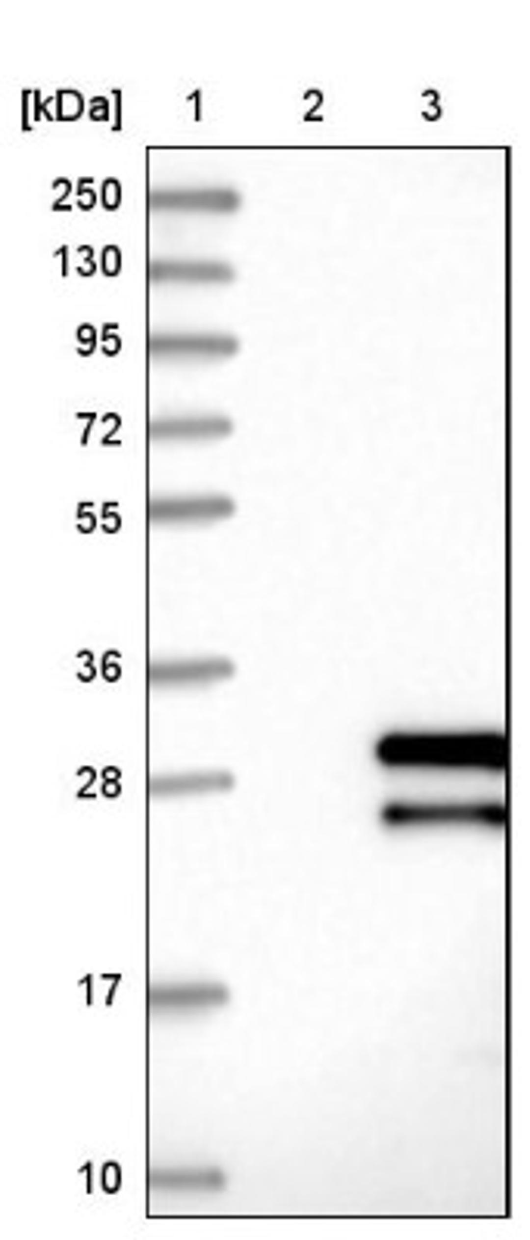 Western Blot: LRRC29 Antibody [NBP1-83919] - Lane 1: Marker [kDa] 250, 130, 95, 72, 55, 36, 28, 17, 10<br/>Lane 2: Negative control (vector only transfected HEK293T lysate)<br/>Lane 3: Over-expression lysate (Co-expressed with a C-terminal myc-DDK tag (~3.1 kDa) in mammalian HEK293T cells, LY415942)