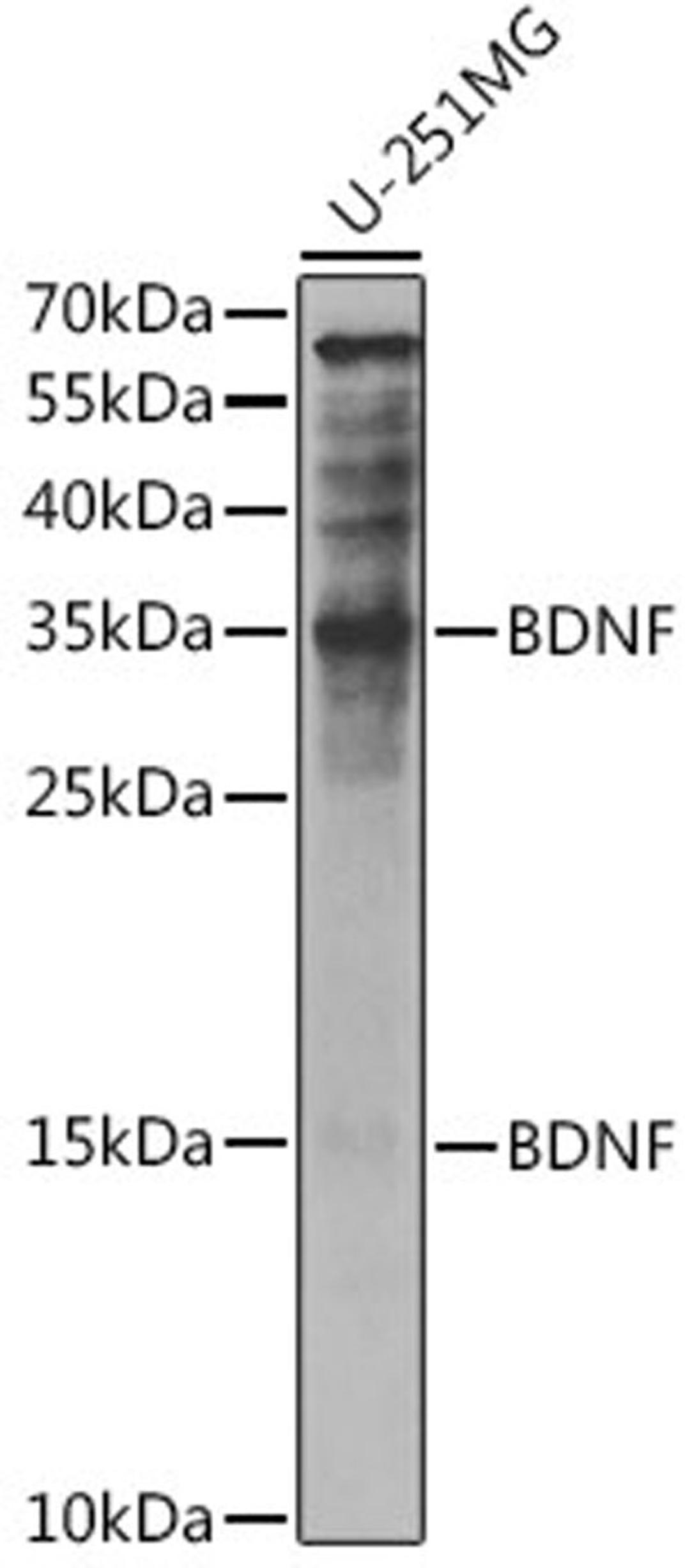 Western blot - BDNF antibody (A11028)