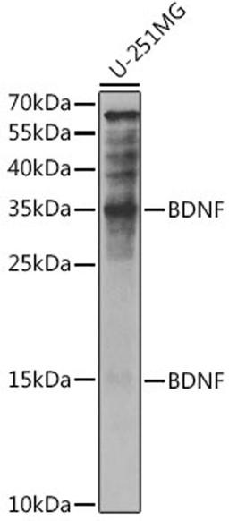 Western blot - BDNF antibody (A11028)