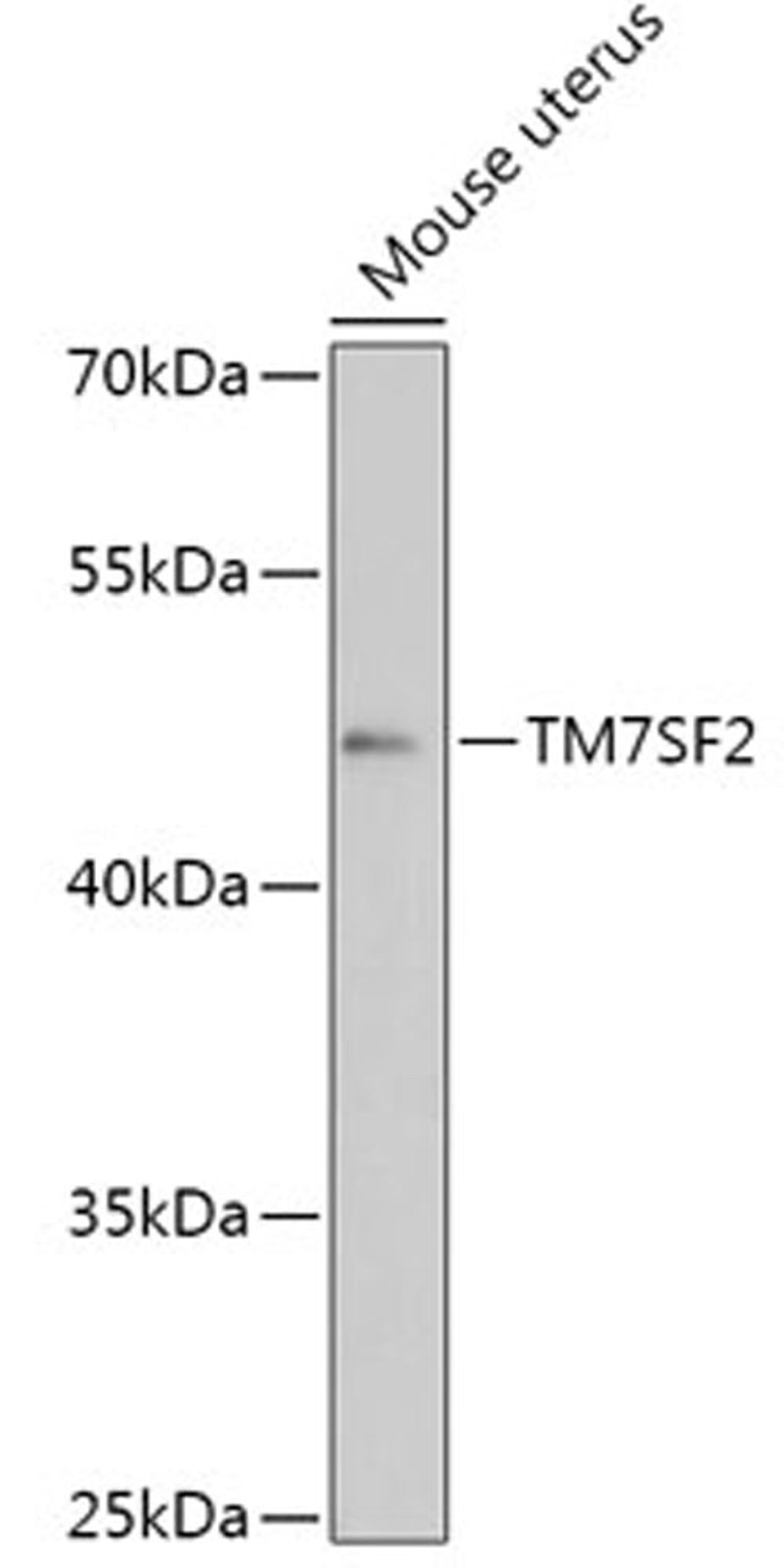 Western blot - TM7SF2 antibody (A17541)