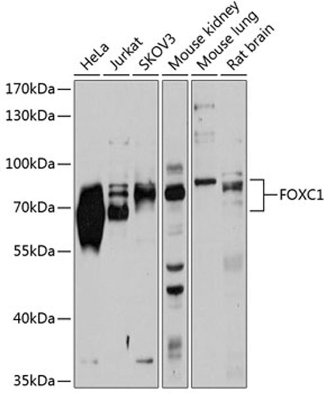 Western blot - FOXC1 antibody (A2924)