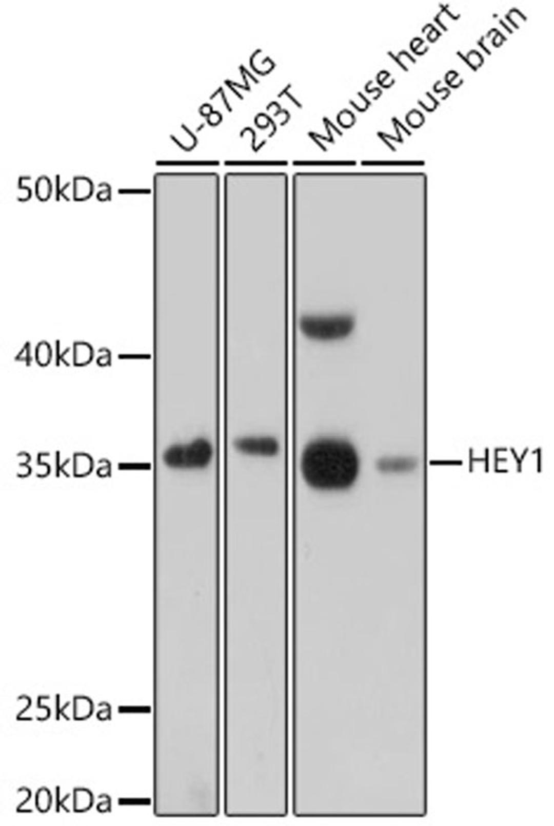 Western blot - HEY1 antibody (A16110)