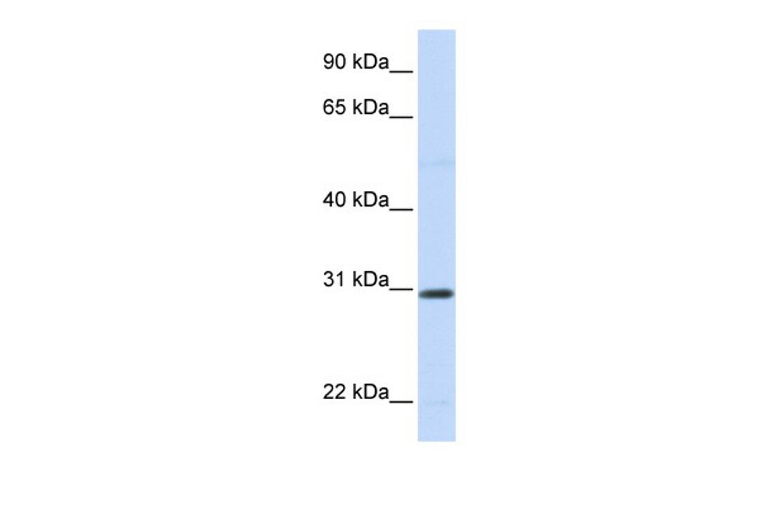 Antibody used in WB on Human 721_B at 0.2-1 ug/ml.