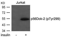 Western blot analysis of extracts from Jurkat cells  untreated or treated with insulin using p56Dok-2(Phospho-Tyr299) Antibody.