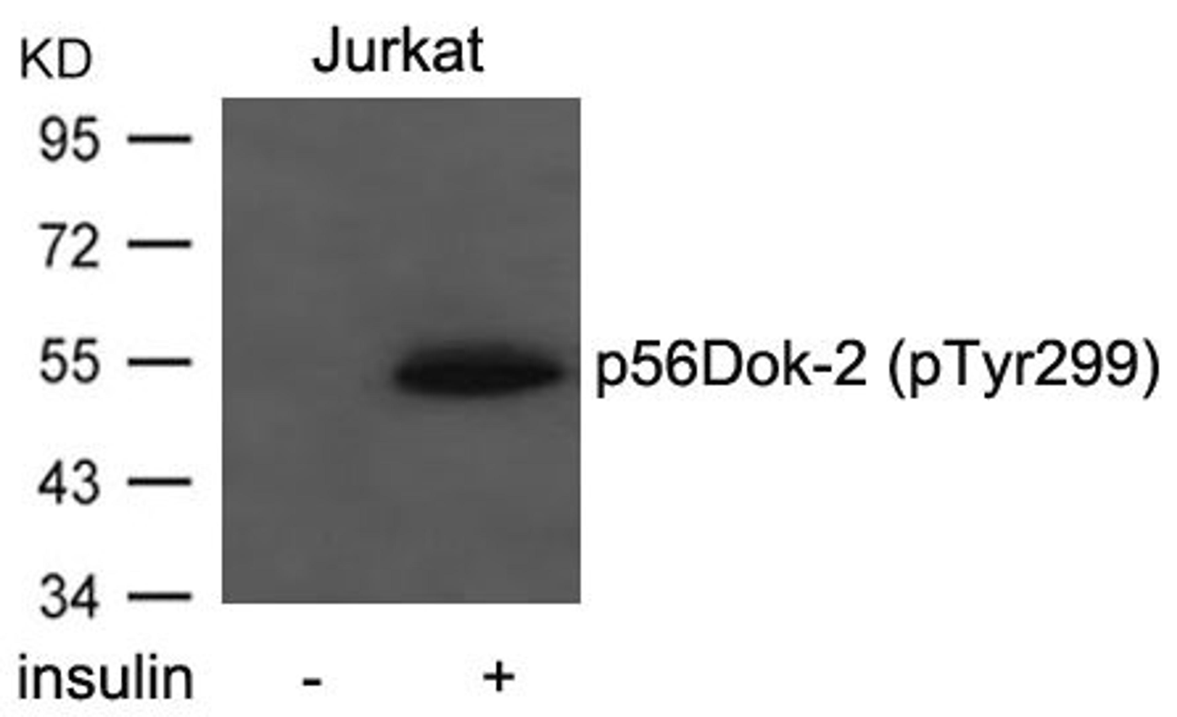 Western blot analysis of extracts from Jurkat cells  untreated or treated with insulin using p56Dok-2(Phospho-Tyr299) Antibody.