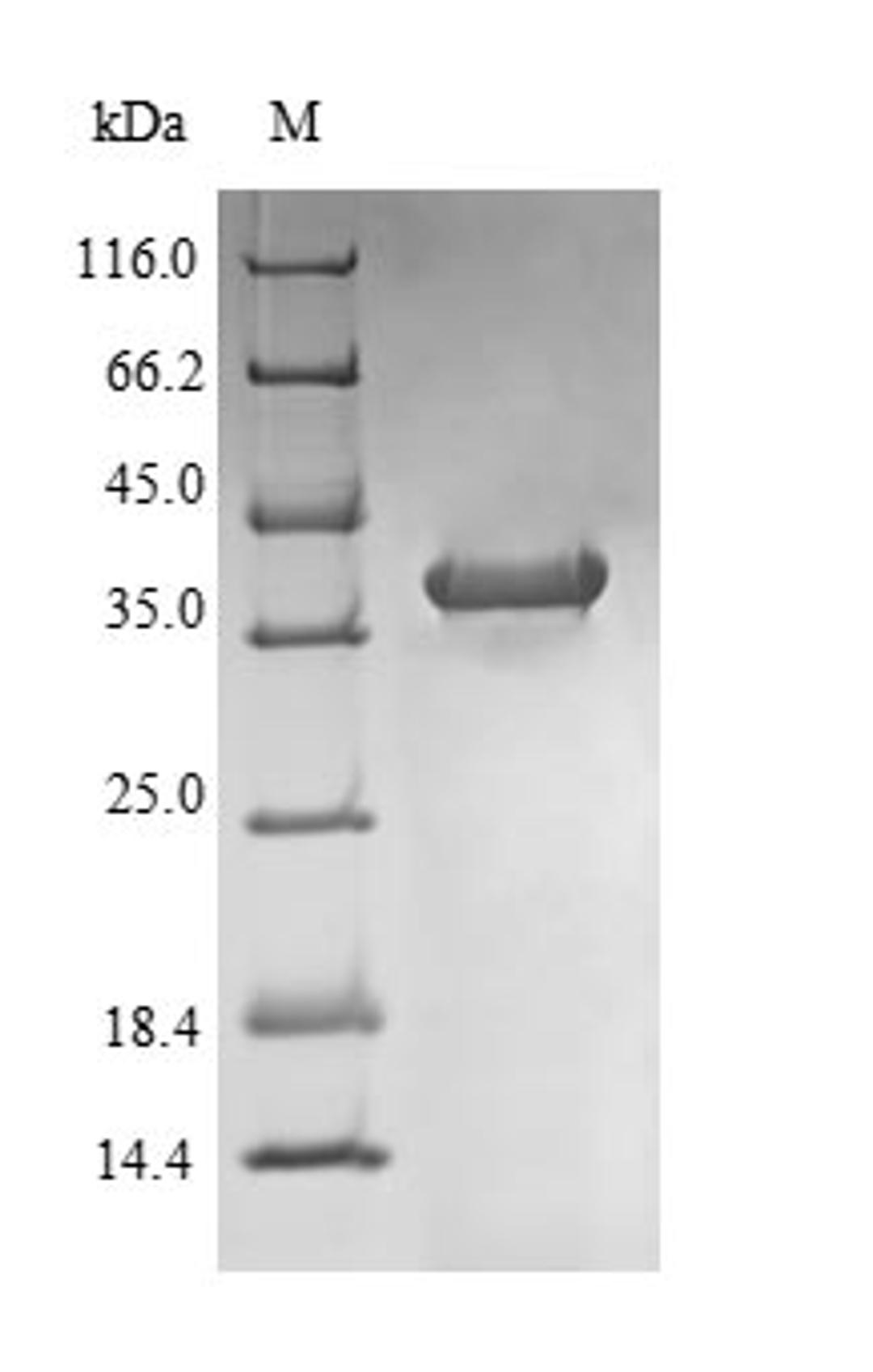 (Tris-Glycine gel) Discontinuous SDS-PAGE (reduced) with 5% enrichment gel and 15% separation gel.