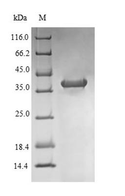(Tris-Glycine gel) Discontinuous SDS-PAGE (reduced) with 5% enrichment gel and 15% separation gel.