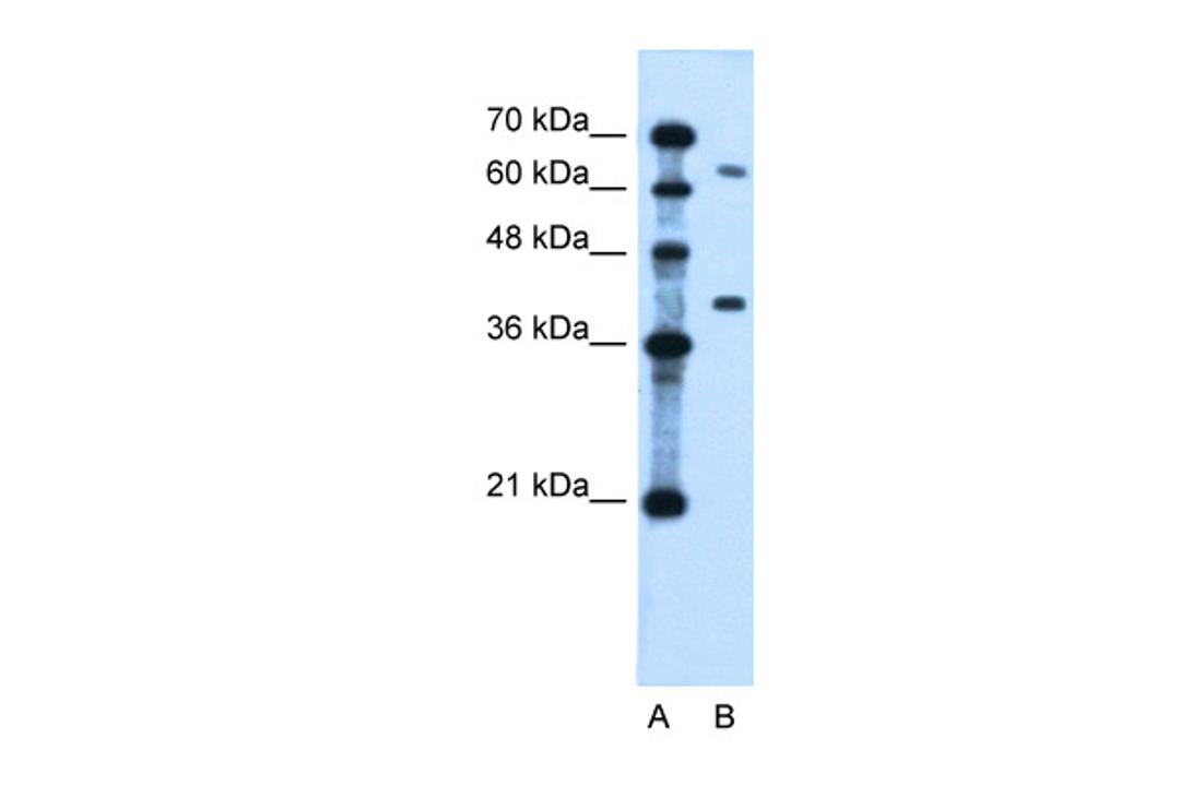 Antibody used in WB on Human Jurkat 0.2-1 ug/ml.