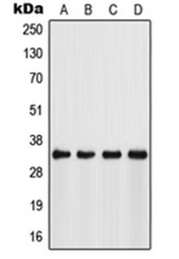 Western blot analysis of Jurkat (Lane 1), HeLa (Lane 2), NIH3T3 (Lane 3), mouse stomach (Lane 4) whole cell lysates using FSBP antibody