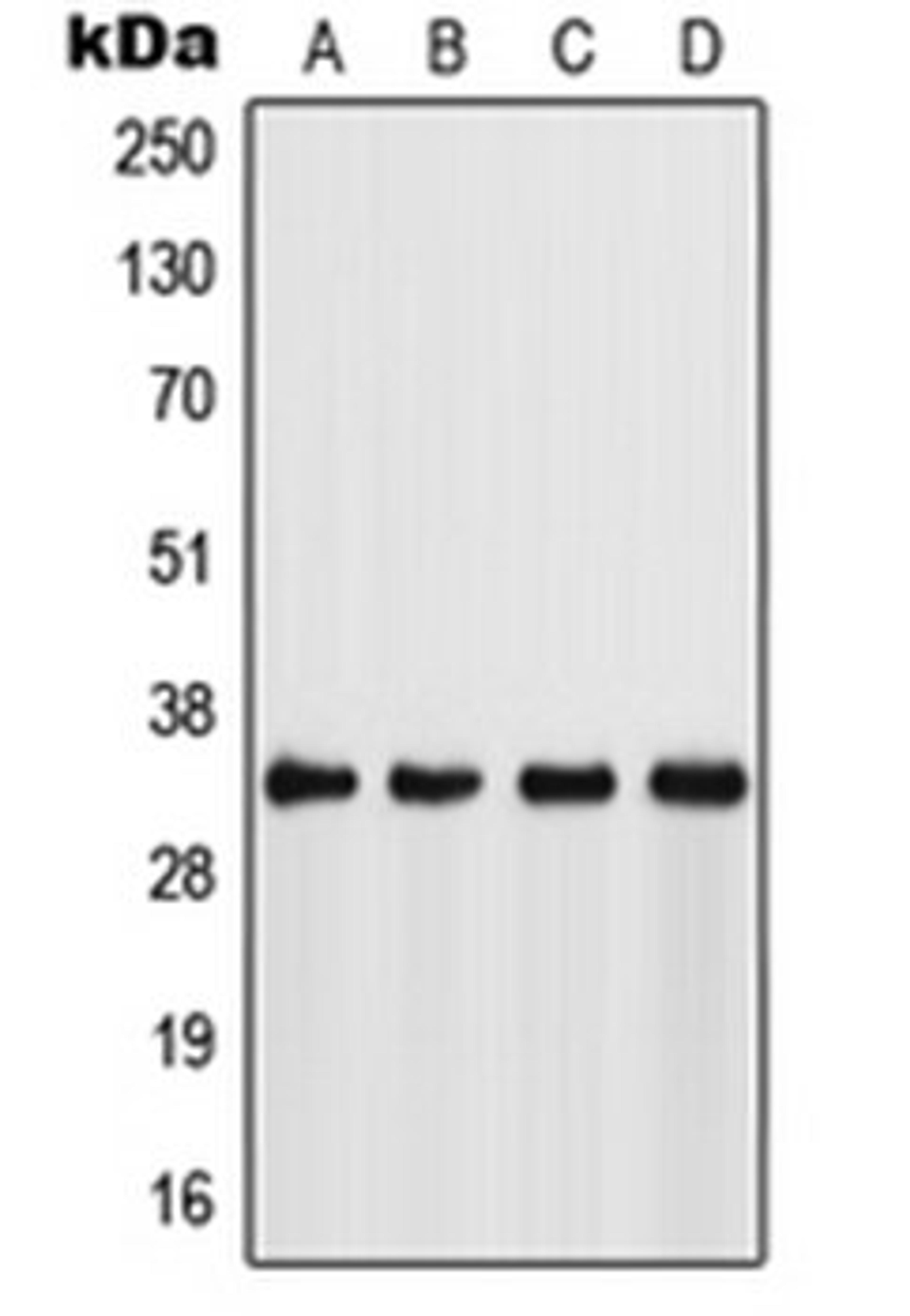 Western blot analysis of Jurkat (Lane 1), HeLa (Lane 2), NIH3T3 (Lane 3), mouse stomach (Lane 4) whole cell lysates using FSBP antibody