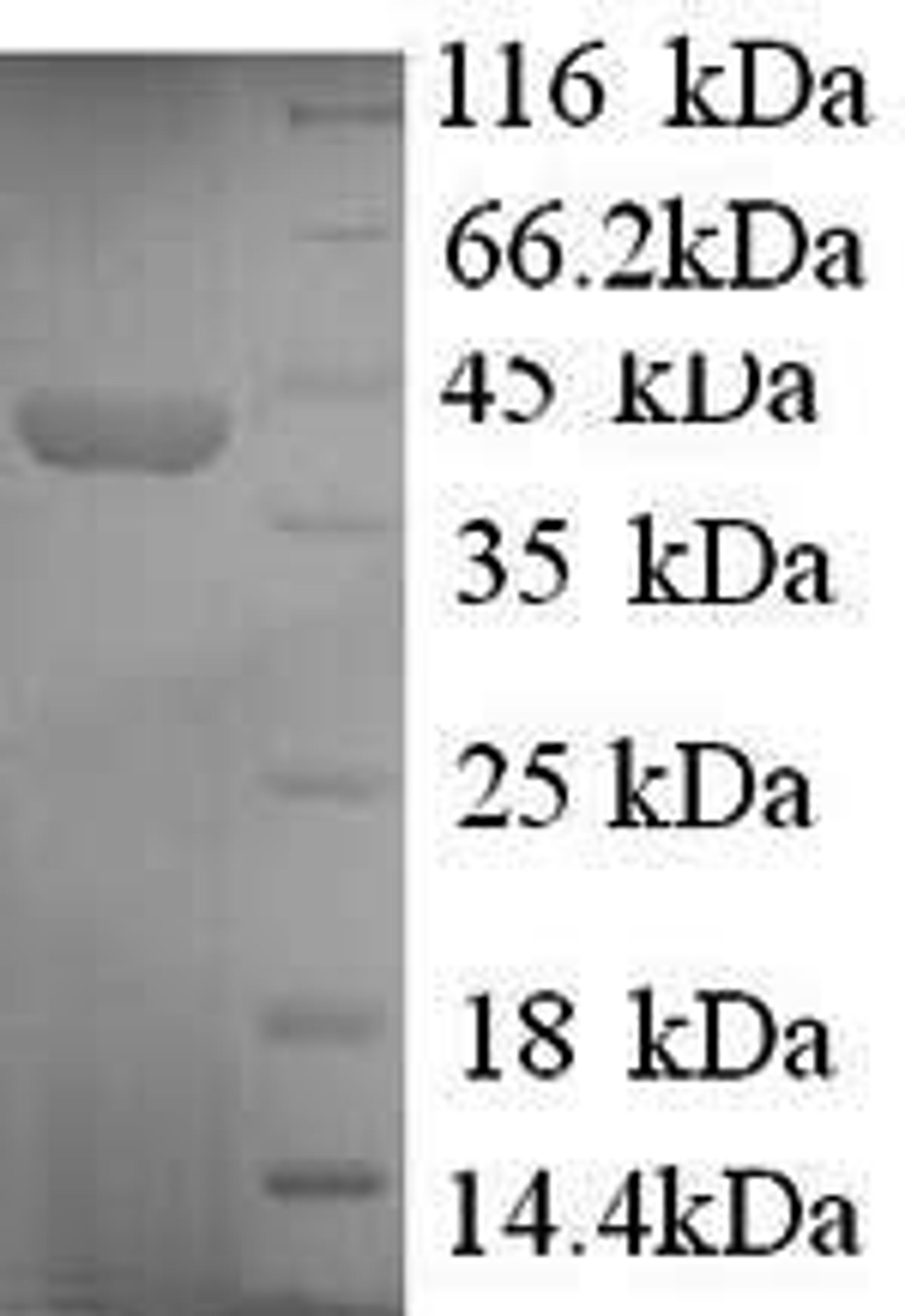 (Tris-Glycine gel) Discontinuous SDS-PAGE (reduced) with 5% enrichment gel and 15% separation gel.