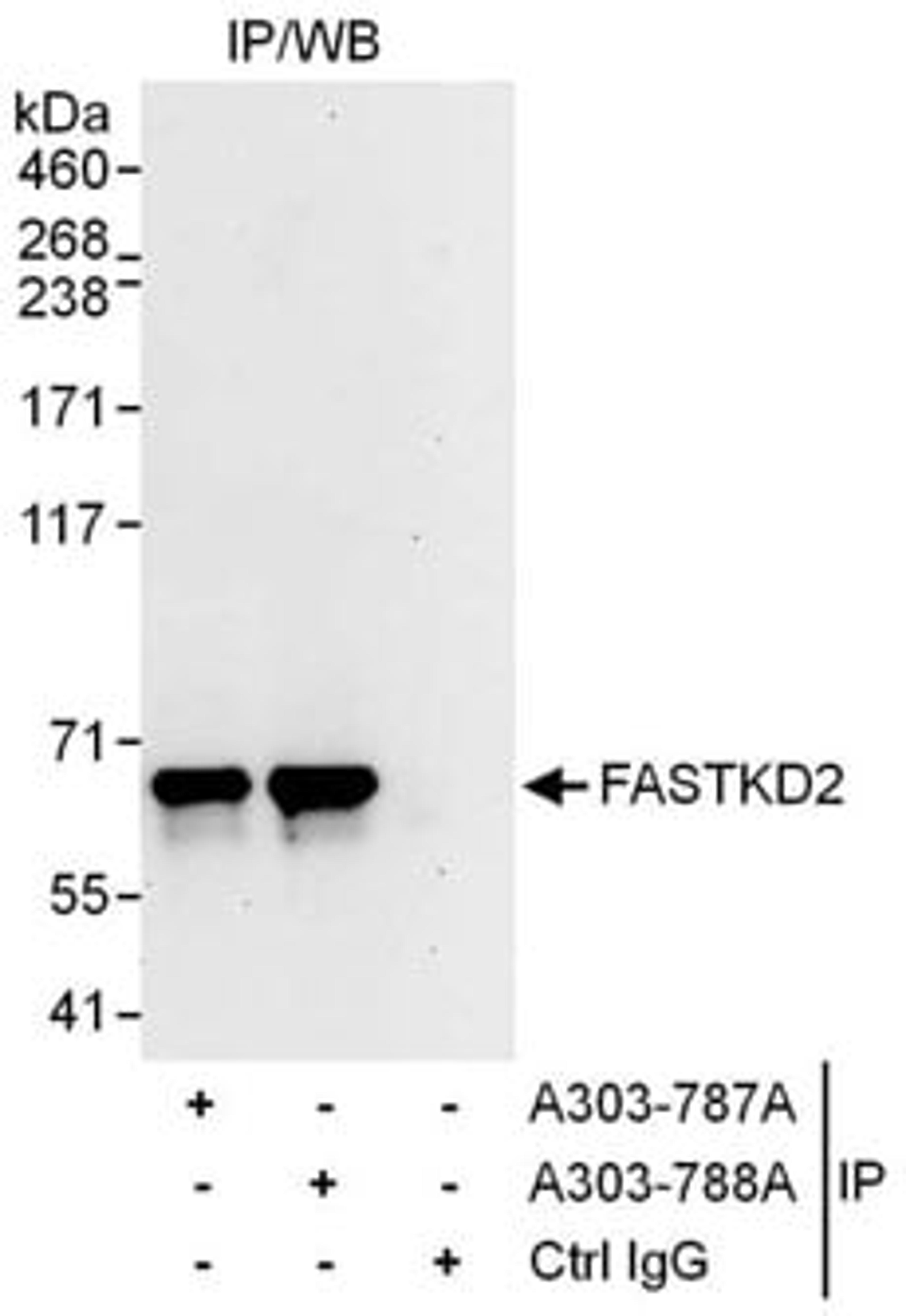 Detection of human FASTKD2 by western blot of immunoprecipitates.