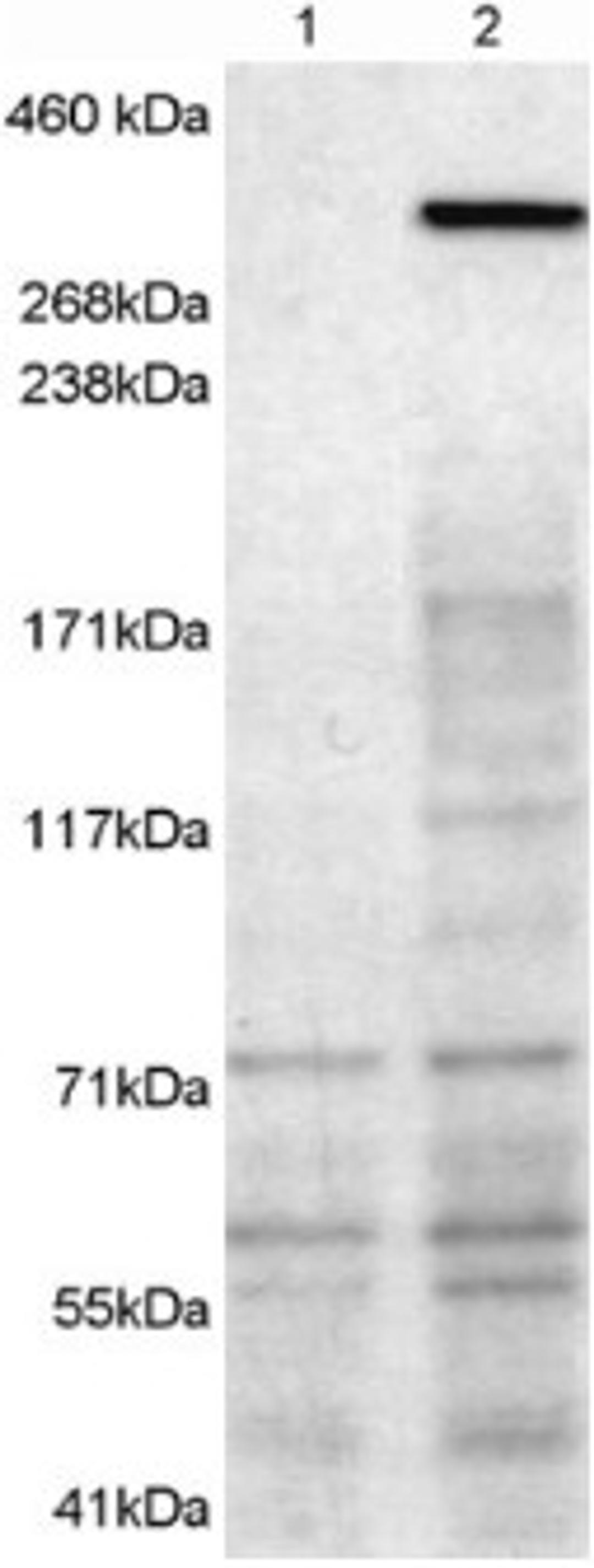 45-951 (1ug/ml) staining of 1) untransfected HEK293T cells 2) HEK293T cells transfected with mouse NBEA. Detected by chemiluminescence.