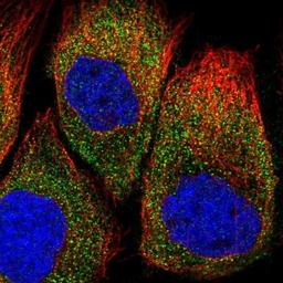 Immunocytochemistry/Immunofluorescence: Epithelial Stromal Interaction 1 Antibody [NBP1-89940] - Staining of human cell line A-431 shows positivity in cytoplasm.