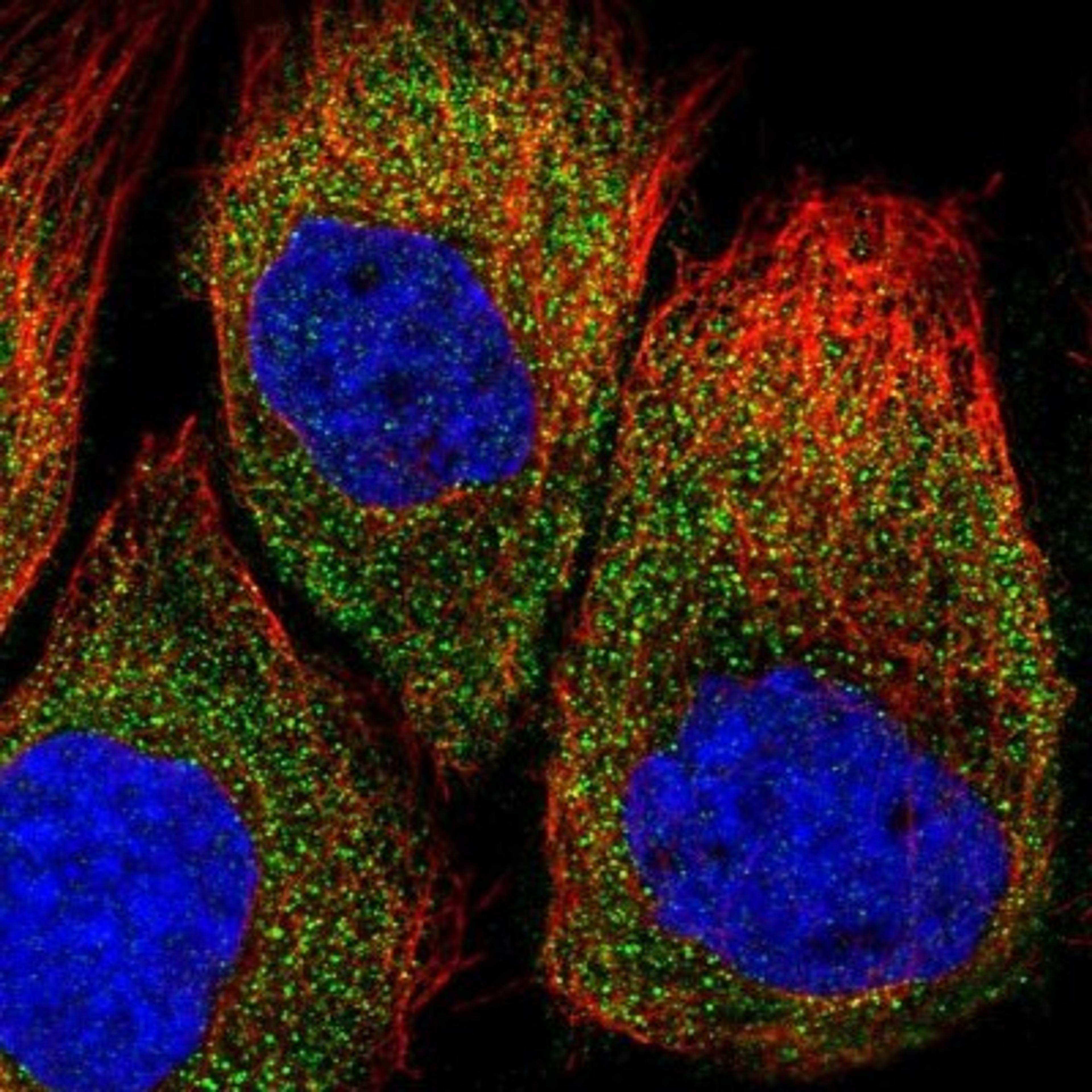 Immunocytochemistry/Immunofluorescence: Epithelial Stromal Interaction 1 Antibody [NBP1-89940] - Staining of human cell line A-431 shows positivity in cytoplasm.