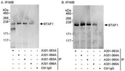 Detection of human BTAF1 by western blot of immunoprecipitates.