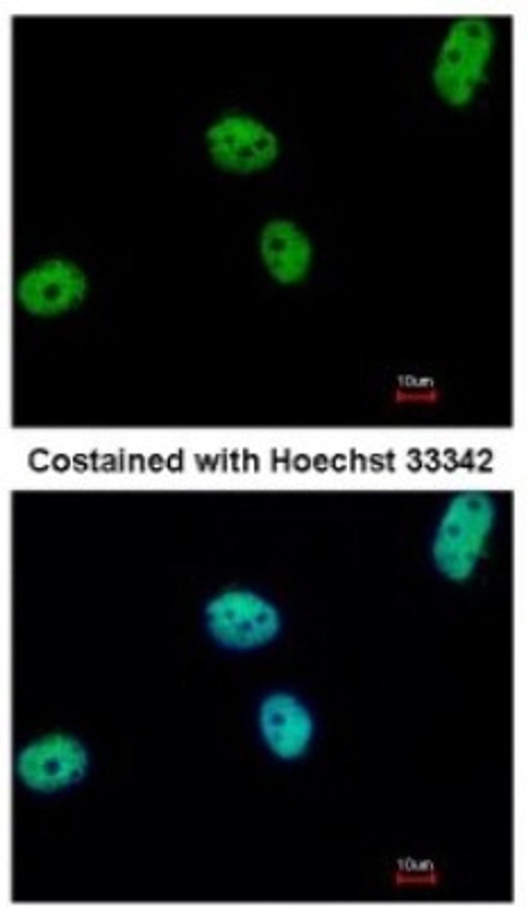 Immunocytochemistry/Immunofluorescence: ERF Antibody [NBP2-16366] - Analysis of paraformaldehyde-fixed HeLa, using antibody at 1:500 dilution.