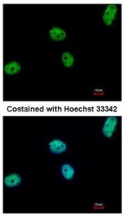 Immunocytochemistry/Immunofluorescence: ERF Antibody [NBP2-16366] - Analysis of paraformaldehyde-fixed HeLa, using antibody at 1:500 dilution.