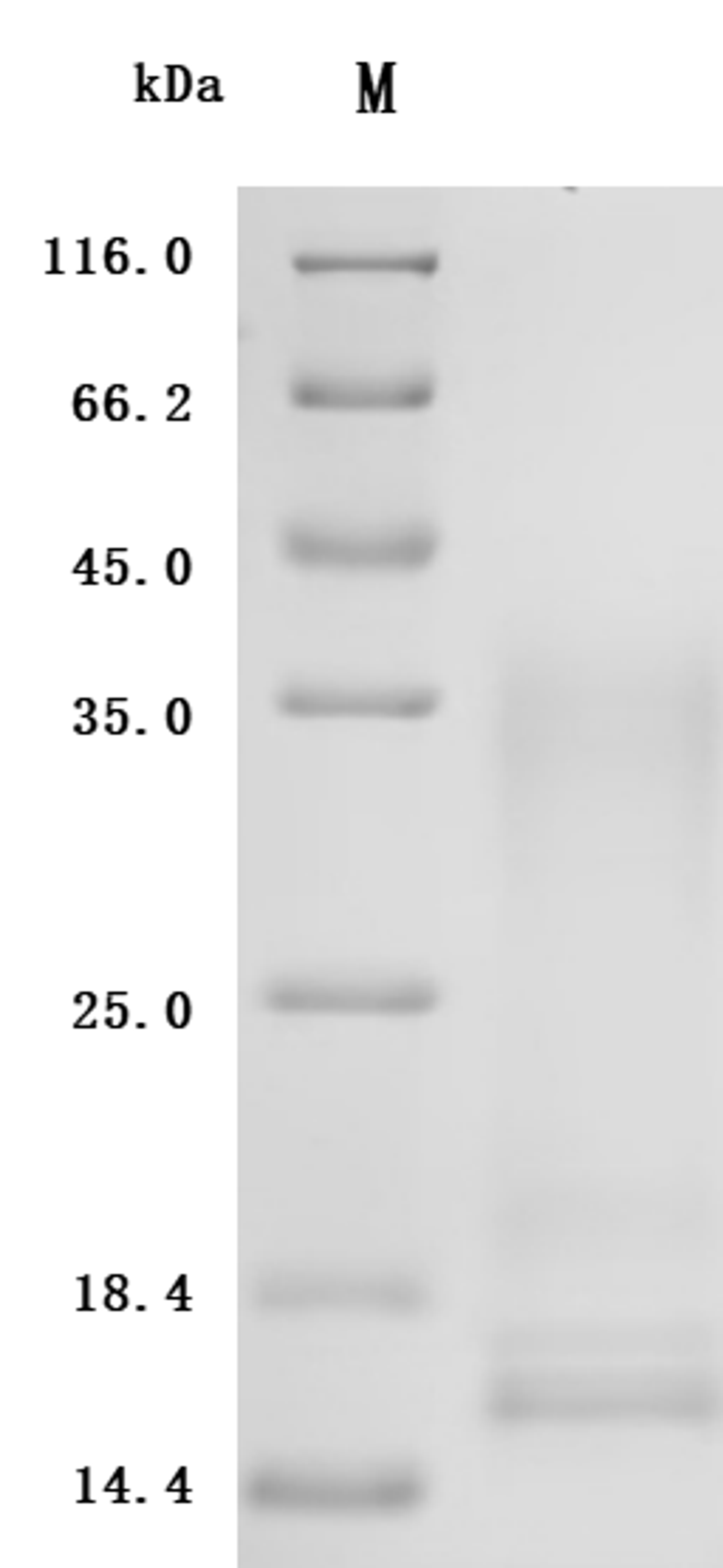 (Tris-Glycine gel) Discontinuous SDS-PAGE (reduced) with 5% enrichment gel and 15% separation gel.