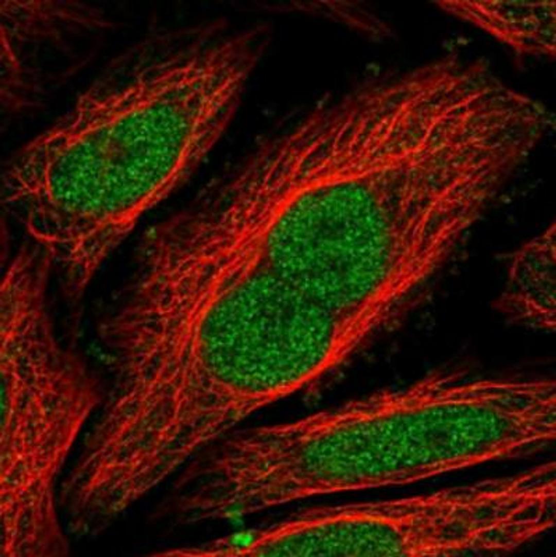 Immunofluorescence: NIPBL Antibody [NBP1-85110] - Staining of human cell line SiHa shows positivity in nucleus but excluded from the nucleoli. Antibody staining is shown in green.