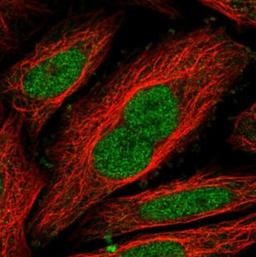 Immunofluorescence: NIPBL Antibody [NBP1-85110] - Staining of human cell line SiHa shows positivity in nucleus but excluded from the nucleoli. Antibody staining is shown in green.