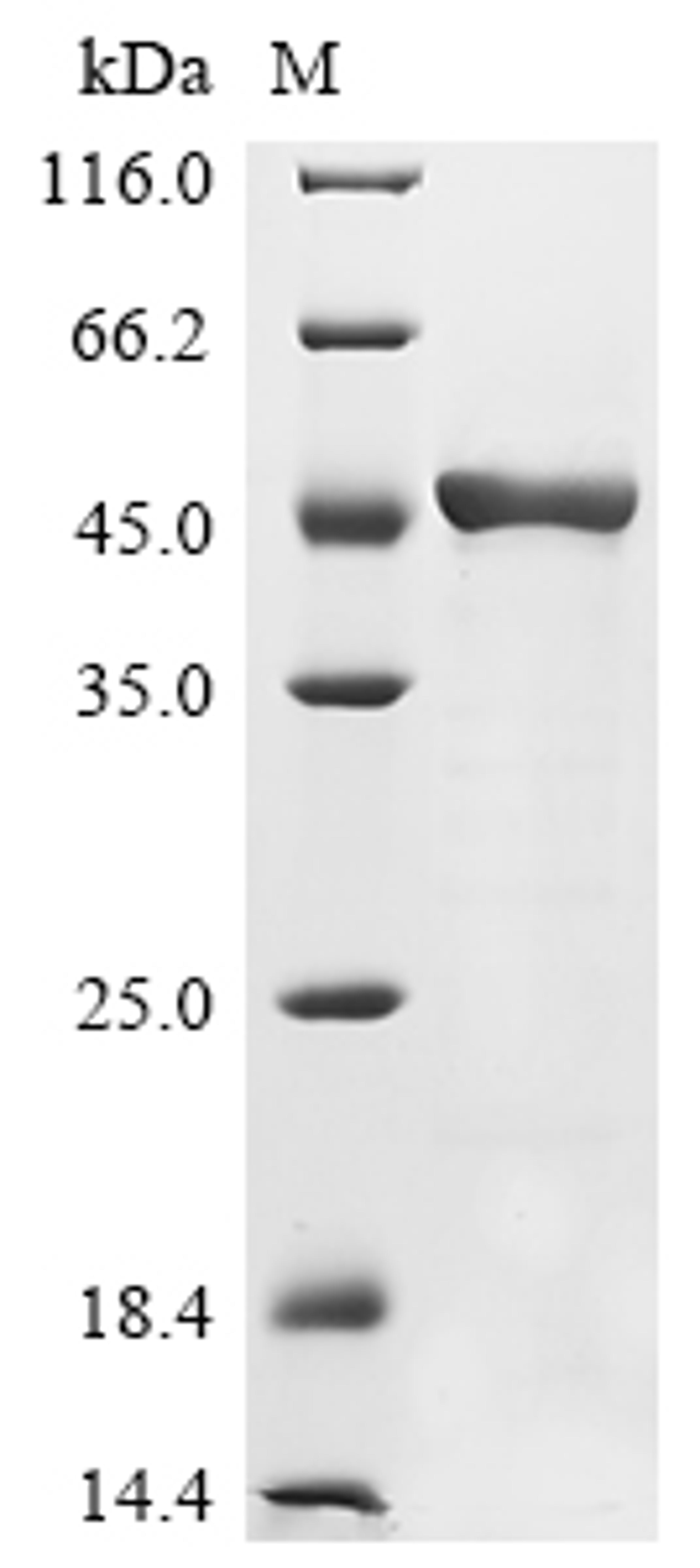 (Tris-Glycine gel) Discontinuous SDS-PAGE (reduced) with 5% enrichment gel and 15% separation gel.