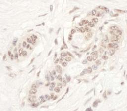 Detection of human NAT10 by immunohistochemistry.