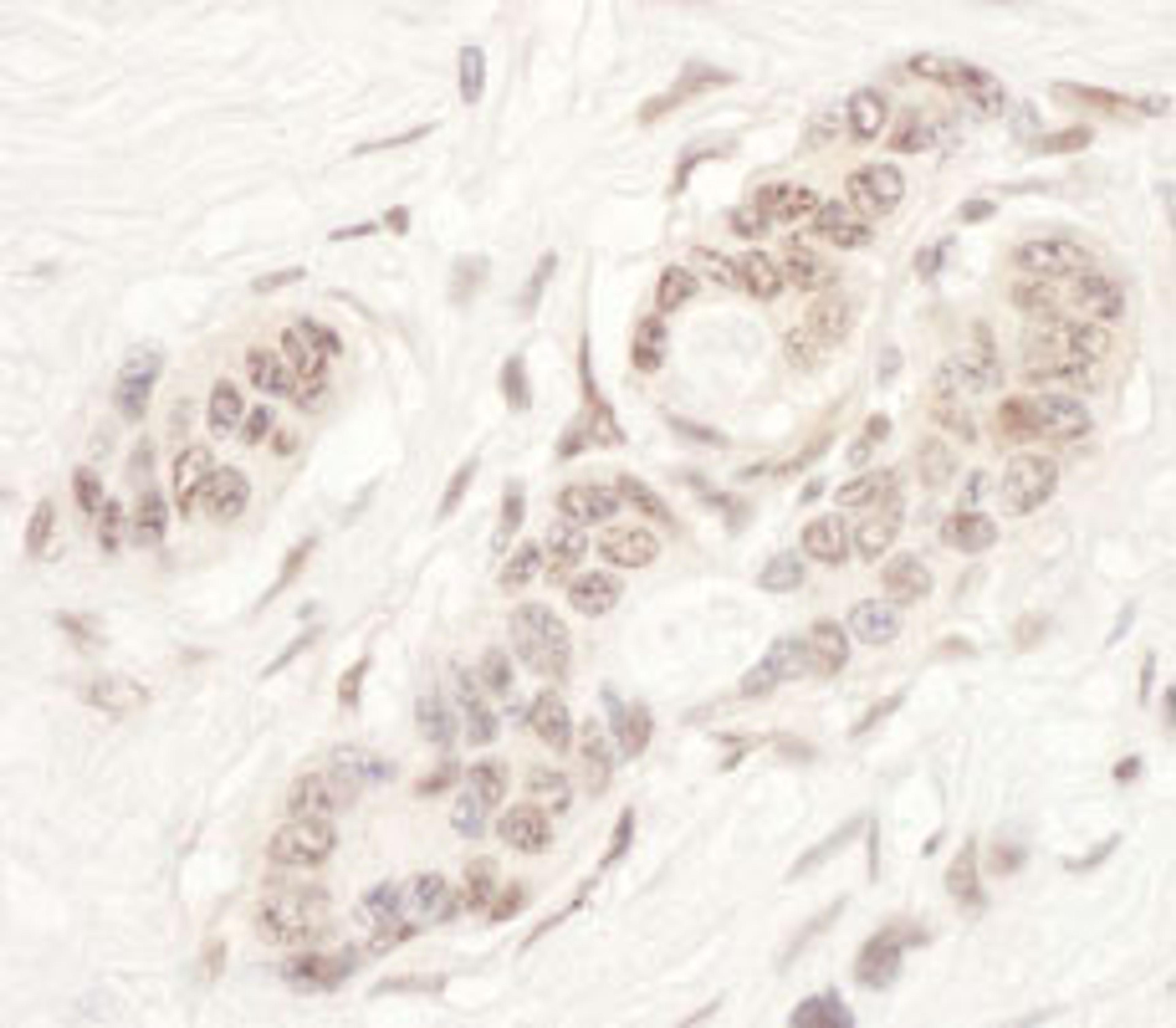 Detection of human NAT10 by immunohistochemistry.