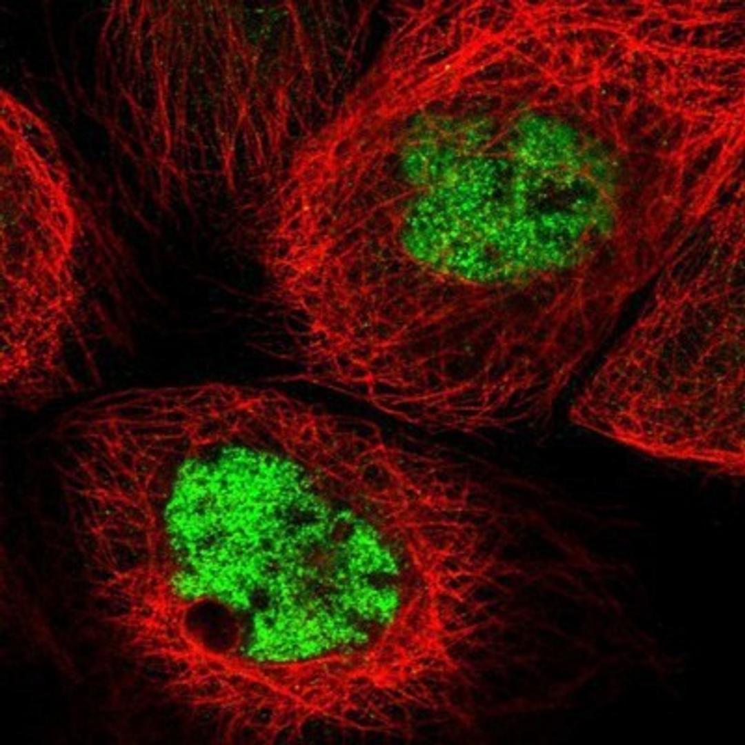 Immunocytochemistry/Immunofluorescence: Kif4A Antibody [NBP1-83720] - Staining of human cell line A-431 shows positivity in nucleus but not nucleoli.