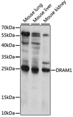 Western blot - DRAM1 antibody (A15468)