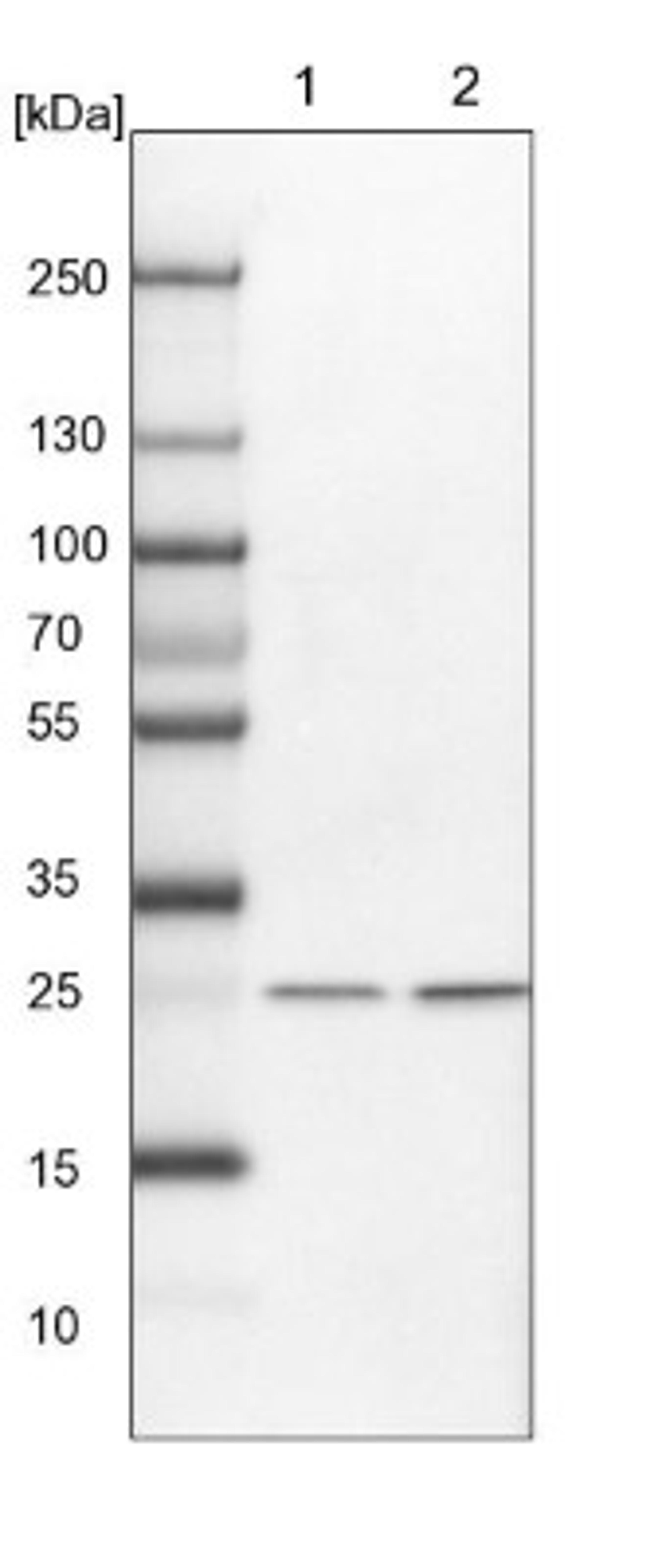 Western Blot: integrin beta 4 binding protein Antibody [NBP2-13954] - Lane 1: NIH-3T3 cell lysate (Mouse embryonic fibroblast cells)<br/>Lane 2: NBT-II cell lysate (Rat Wistar bladder tumour cells)