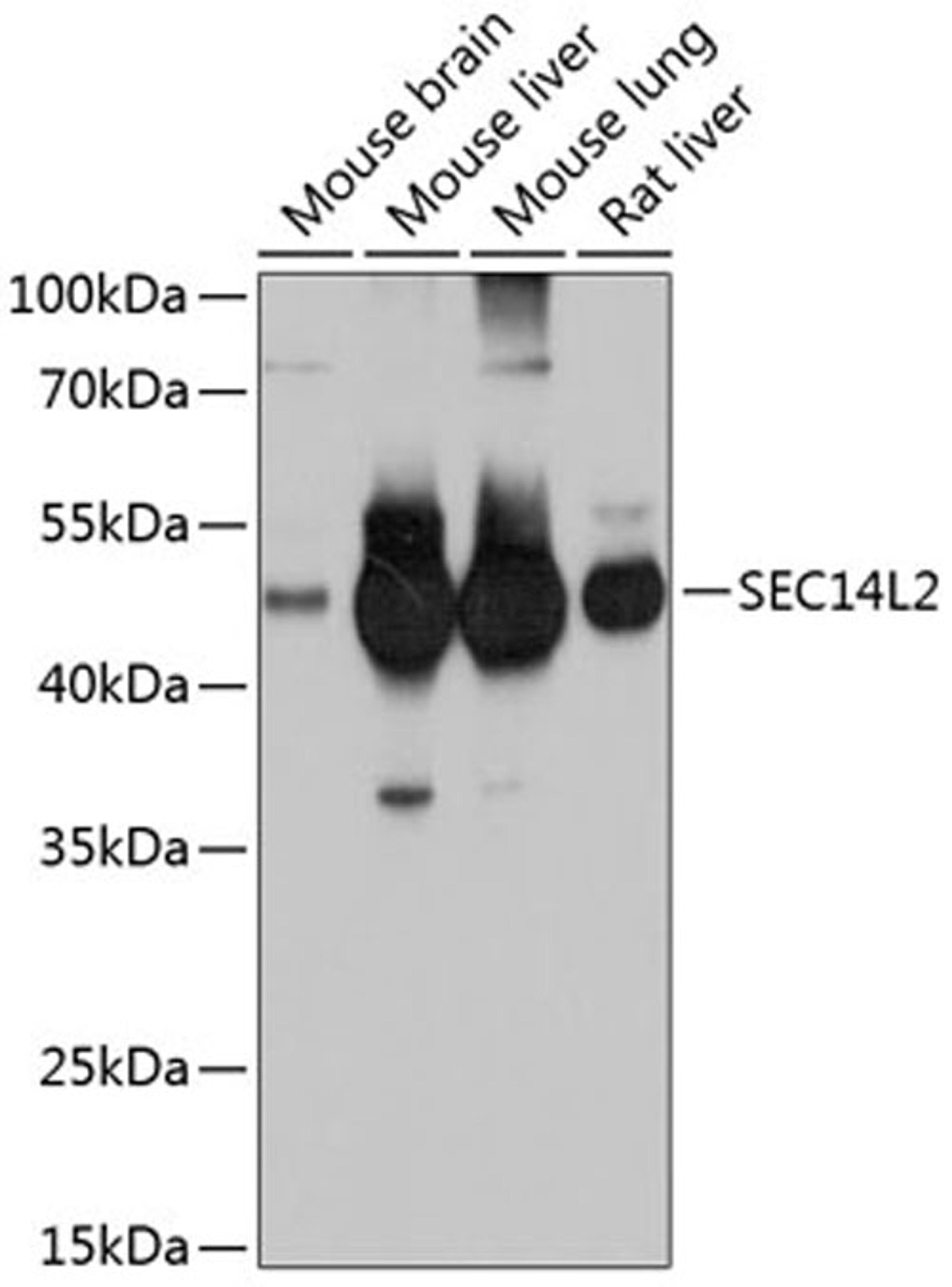 Western blot - SEC14L2 antibody (A10586)