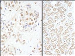 Detection of human c-Myb by immunohistochemistry.