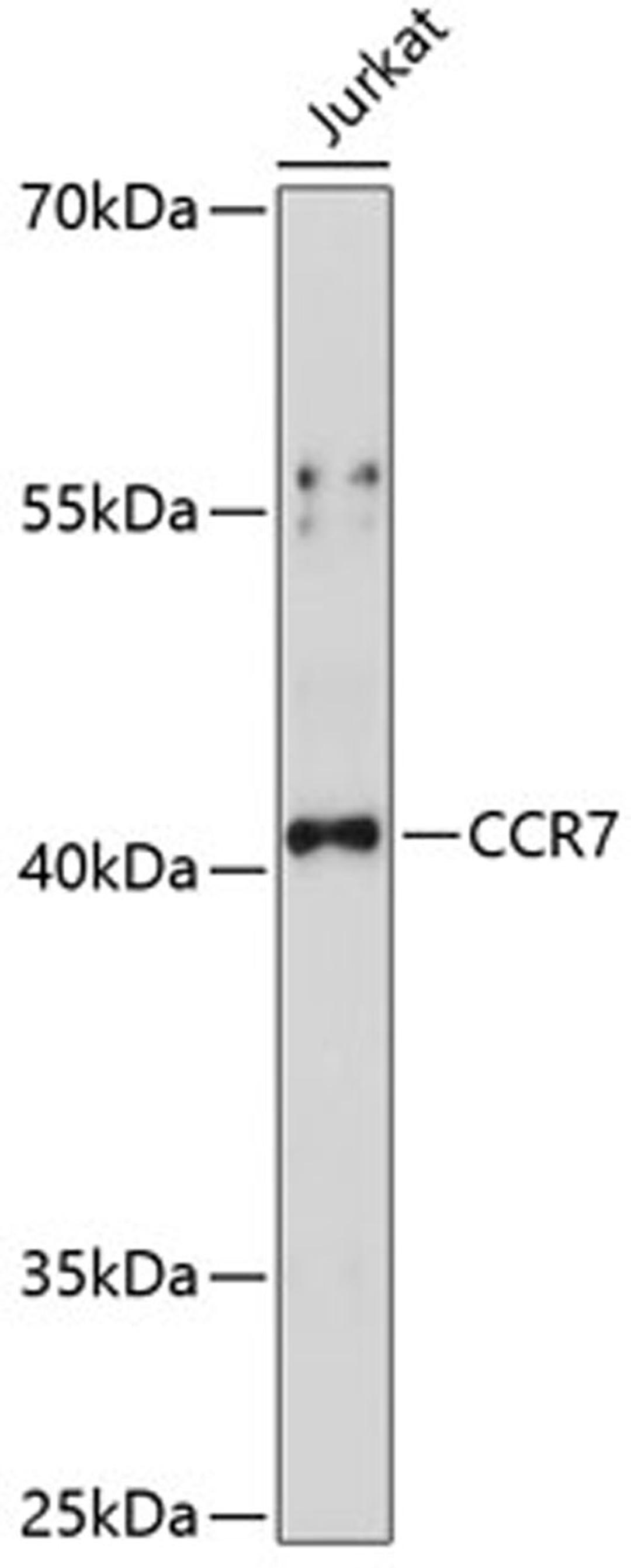 Western blot - CCR7 antibody (A14718)