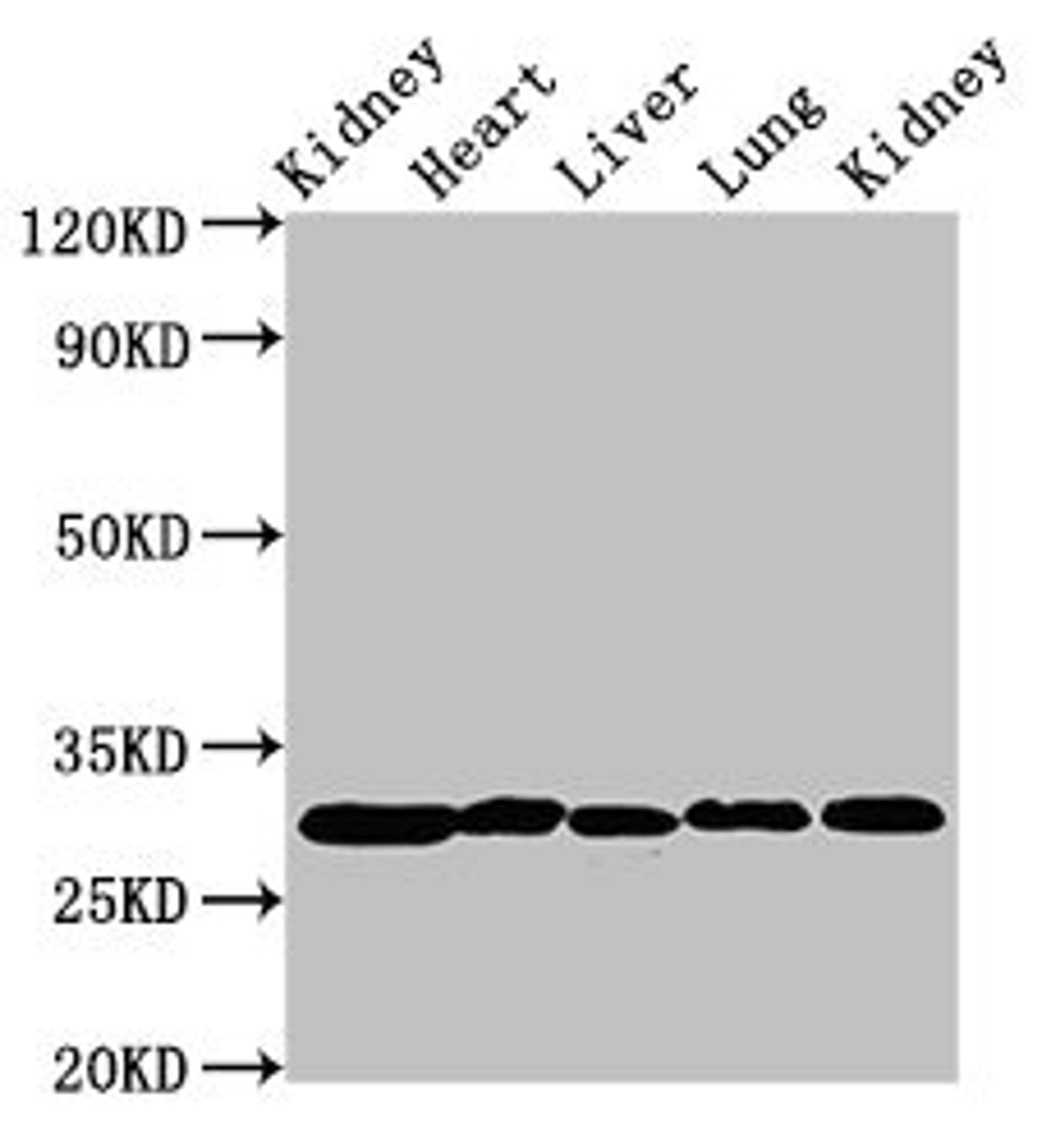 Western Blot. Positive WB detected in: Rat kidney tissue, Rat heart tissue, Rat liver tissue, Mouse lung tissue, Mouse kidney tissue. All lanes: CA2 antibody at 2µg/ml. Secondary. Goat polyclonal to rabbit IgG at 1/50000 dilution. Predicted band size: 30 kDa. Observed band size: 30 kDa