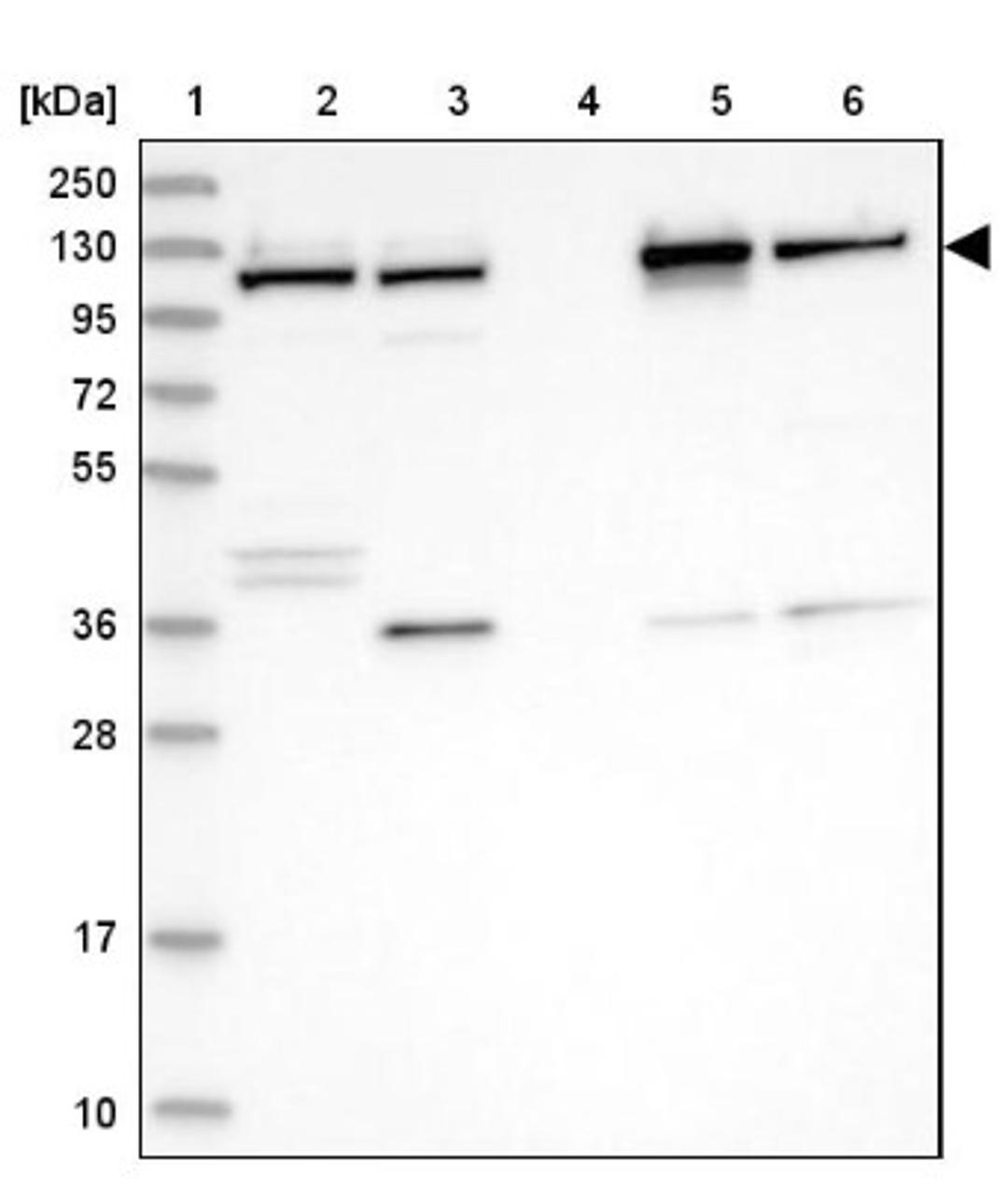 Western Blot: VDP p115 Antibody [NBP2-38401] - Lane 1: Marker [kDa] 250, 130, 95, 72, 55, 36, 28, 17, 10<br/>Lane 2: RT-4<br/>Lane 3: U-251 MG<br/>Lane 4: Human Plasma<br/>Lane 5: Liver<br/>Lane 6: Tonsil