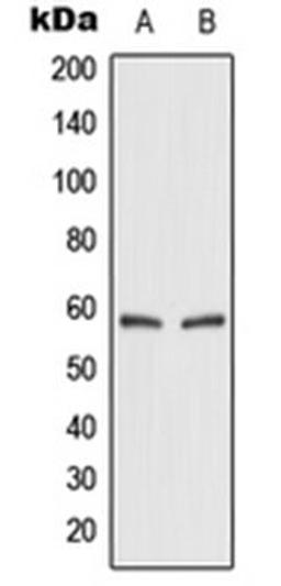 Western blot analysis of HEK293T (Lane 1), rat kidney (Lane 2) whole cell lysates using SLC2A2 antibody