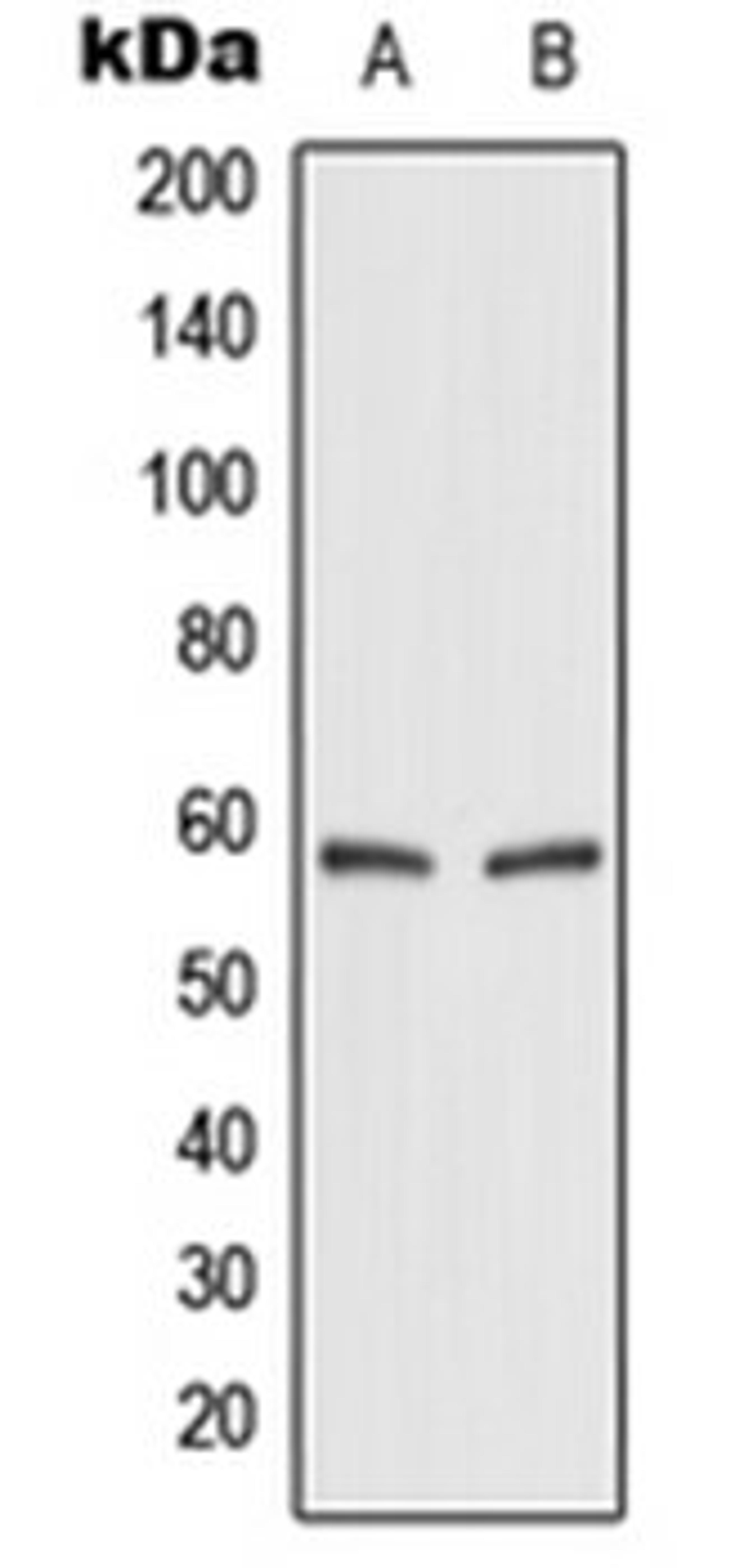 Western blot analysis of HEK293T (Lane 1), rat kidney (Lane 2) whole cell lysates using SLC2A2 antibody