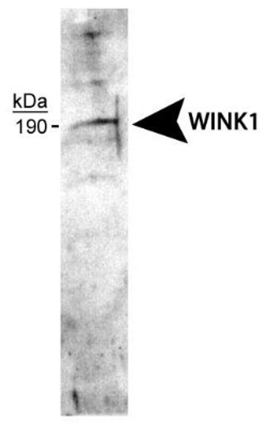 Western Blot: WNK1 Antibody [NB600-225] - Detection of the short form of WNK1 in F-11 cell lysate.