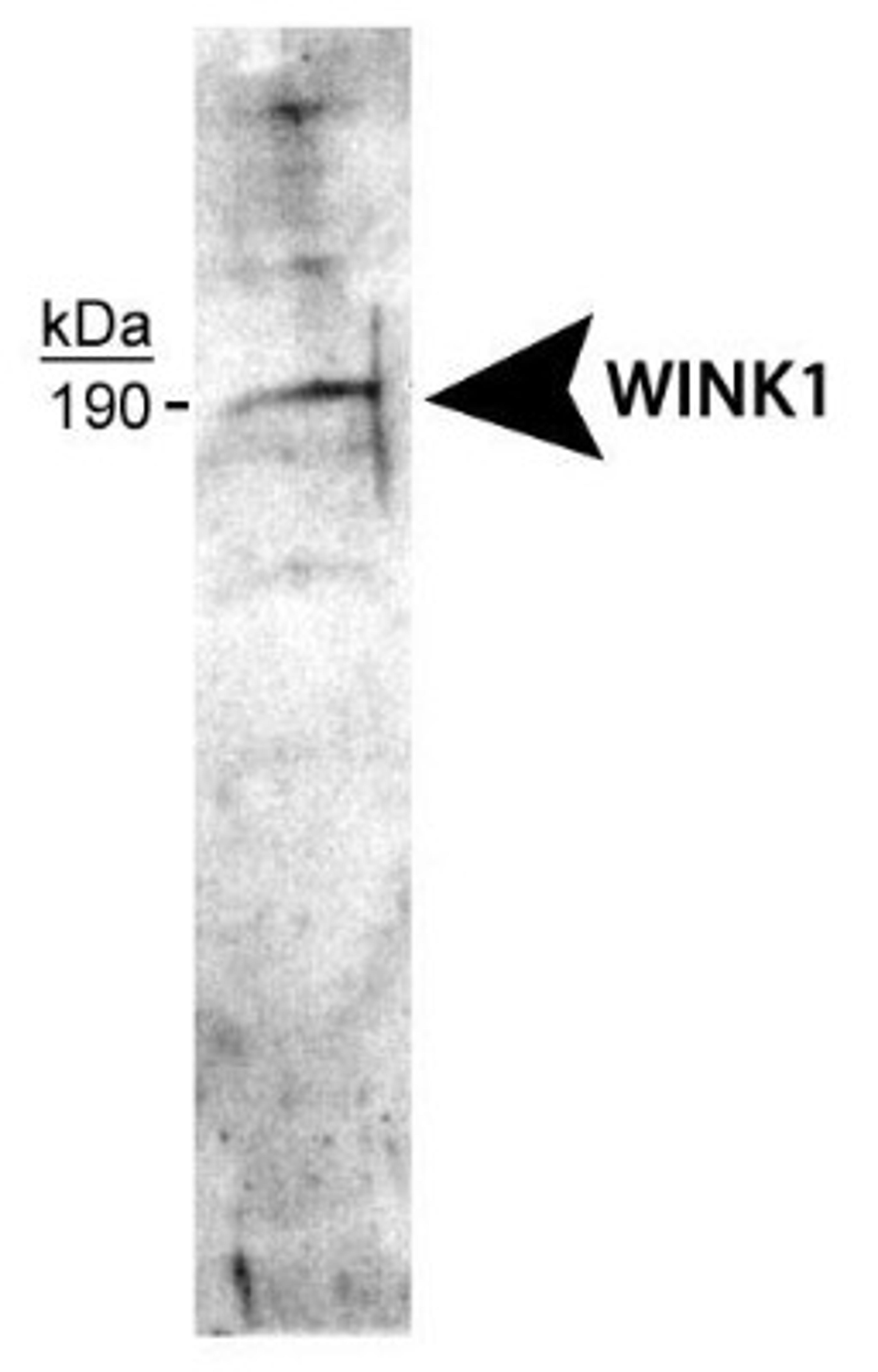 Western Blot: WNK1 Antibody [NB600-225] - Detection of the short form of WNK1 in F-11 cell lysate.