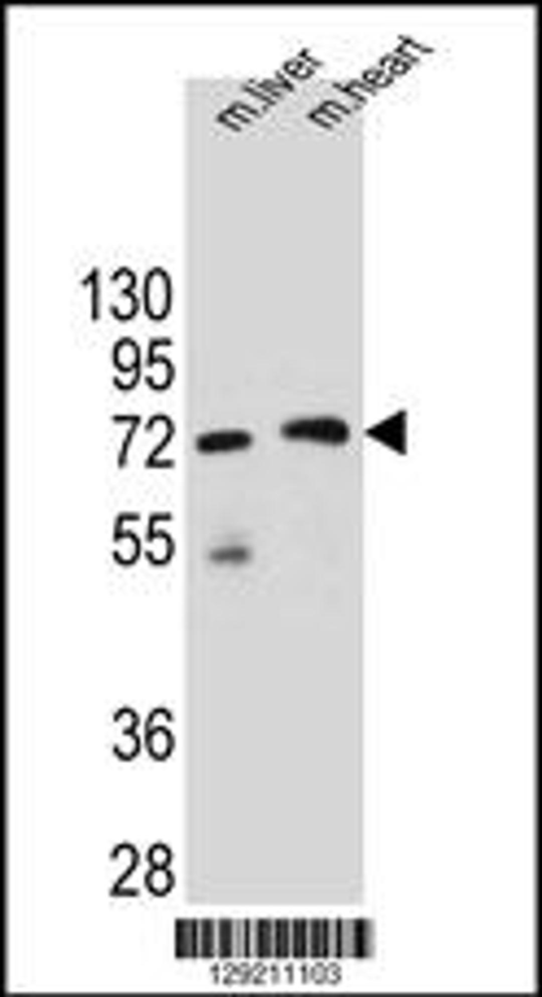 Western blot analysis in mouse liver and heart tissue lysates (35ug/lane).