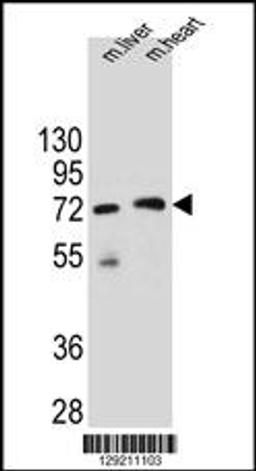 Western blot analysis in mouse liver and heart tissue lysates (35ug/lane).