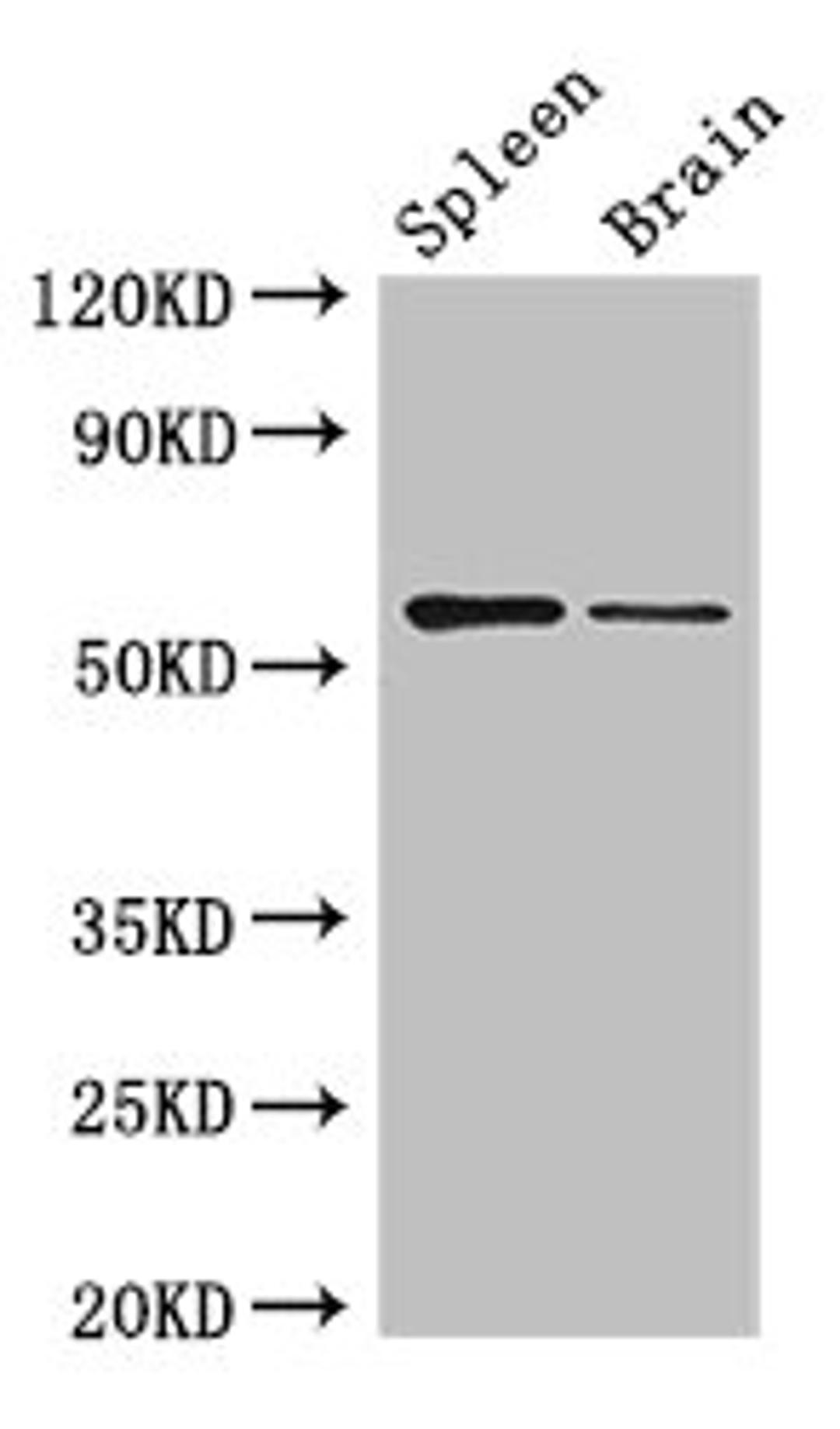 Western Blot. Positive WB detected in: Mouse spleen tissue, Mouse brain tissue. All lanes: D2HGDH antibody at 3ug/ml. Secondary. Goat polyclonal to rabbit IgG at 1/50000 dilution. Predicted band size: 57, 33, 35 kDa. Observed band size: 57 kDa. 