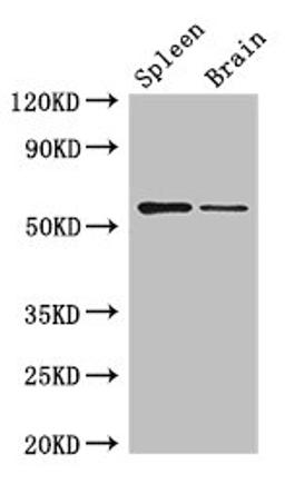 Western Blot. Positive WB detected in: Mouse spleen tissue, Mouse brain tissue. All lanes: D2HGDH antibody at 3ug/ml. Secondary. Goat polyclonal to rabbit IgG at 1/50000 dilution. Predicted band size: 57, 33, 35 kDa. Observed band size: 57 kDa. 