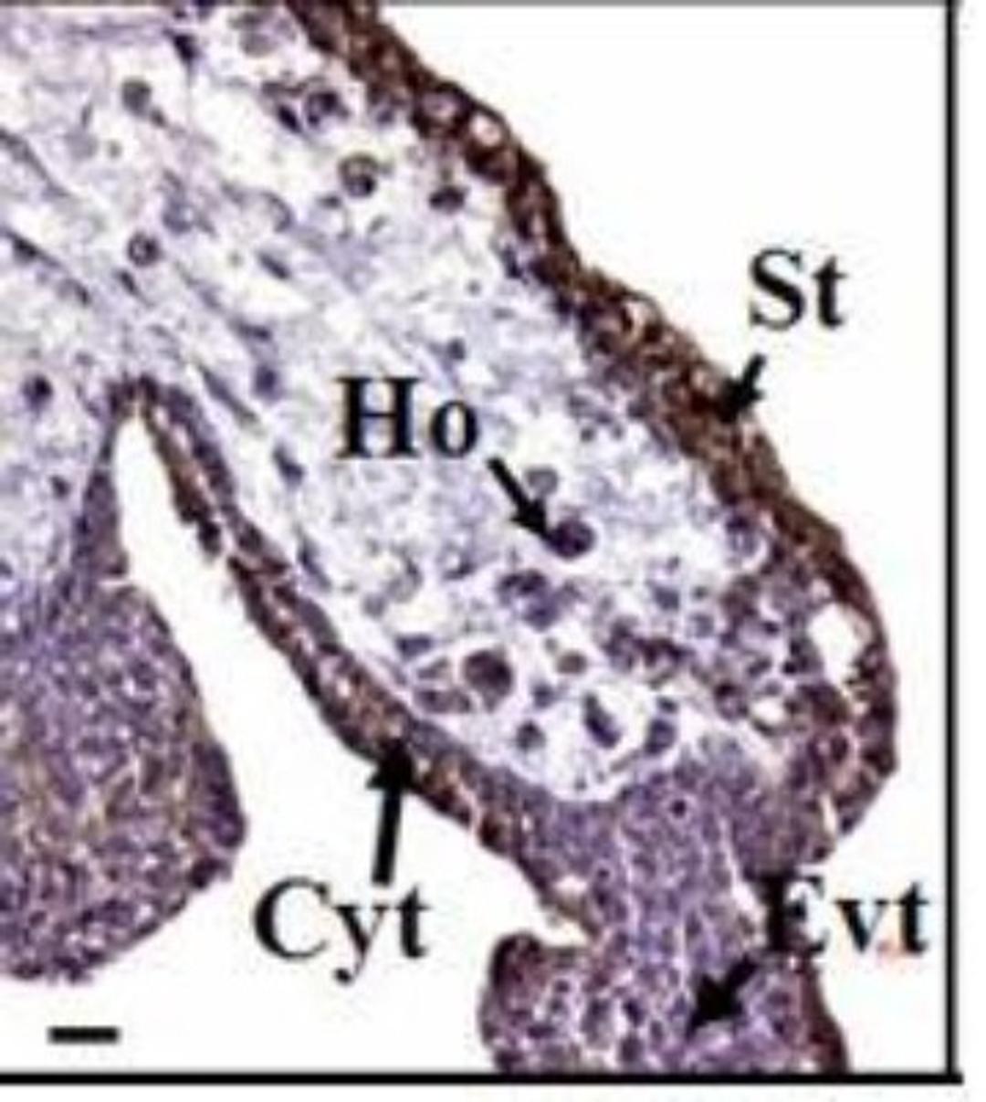 Immunohistochemistry-Paraffin: Prokineticin 1 Antibody [NB100-2901] - Cytotrophoblast(Cyt), Hobfauer Cells(Ho), Extravillous trophoblast(EVT), Syncytiotrophoblast(st)