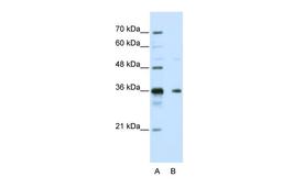 Antibody used in WB on Human HepG2 at 5.0 ug/ml.