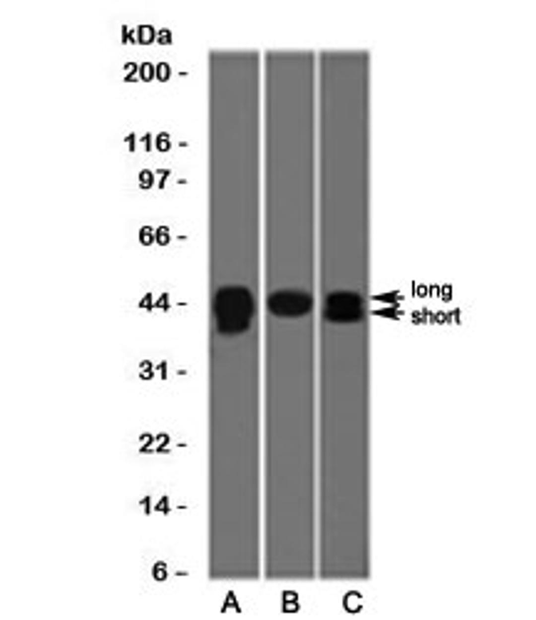 Western blot testing of A) HepG2, B) PC3 and C) HeLa cell lysate wiht TIA-1 antibody (clone TRIA1-1). The long and short forms differ by 17 amino acids. Predicted molecular weight: ~43kDa and ~15kDa (granulocyte-associated isoform).