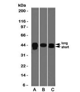 Western blot testing of A) HepG2, B) PC3 and C) HeLa cell lysate wiht TIA-1 antibody (clone TRIA1-1). The long and short forms differ by 17 amino acids. Predicted molecular weight: ~43kDa and ~15kDa (granulocyte-associated isoform).