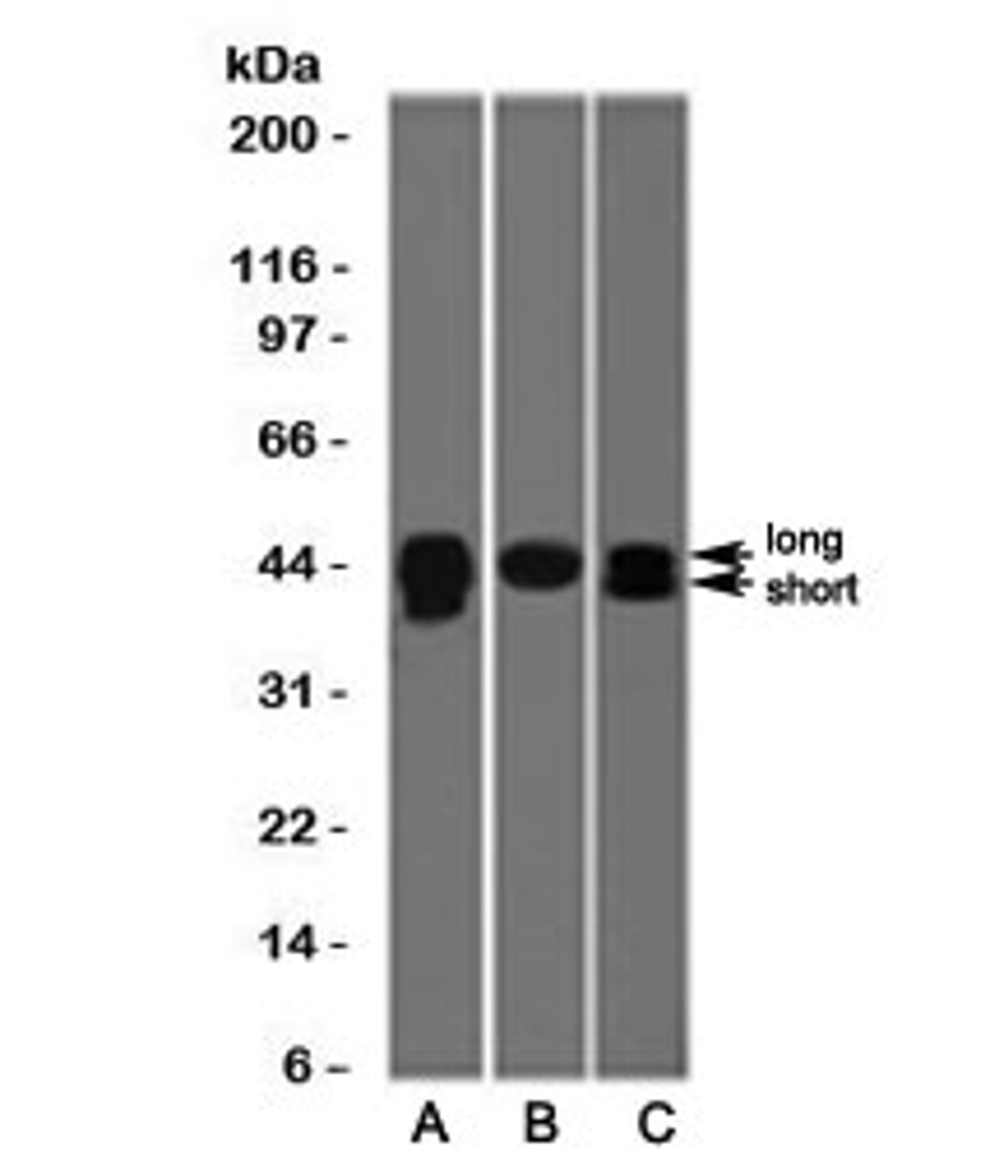 Western blot testing of A) HepG2, B) PC3 and C) HeLa cell lysate wiht TIA-1 antibody (clone TRIA1-1). The long and short forms differ by 17 amino acids. Predicted molecular weight: ~43kDa and ~15kDa (granulocyte-associated isoform).